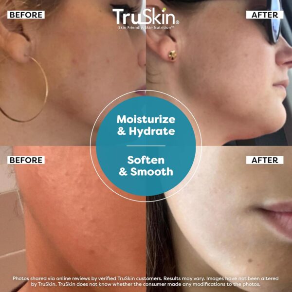 TruSkin Hyaluronic Acid Serum for Face + 7 Ultra Hydrating Ingredients