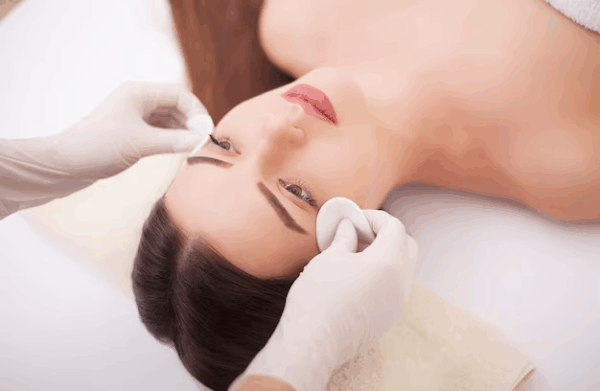 ABremoval