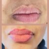 WhatsApp Image 2025-08-29 at 18.44.06 Lip Liner Tattooing