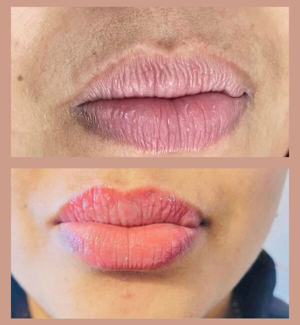 WhatsApp Image 2025-08-29 at 18.44.06 Lip Liner Tattooing